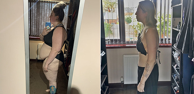 Nemohla se vysoukat ze svatebních šatů, tak se žena rozhodla zhubnout